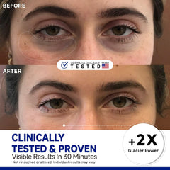 Dr Vincent patches applied to eye area offering soothing relief