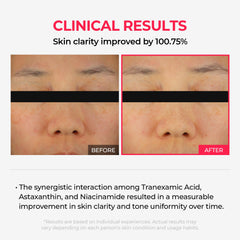 Dr.Melaxin TXA texture close-up reveals smooth, creamy consistency.