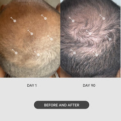 DS Labs StimuROLLER ergonomic handle enables precise, comfortable rolling during scalp care.