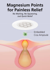 DWEasyDerm included tweezers for precise patch placement