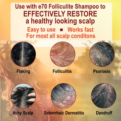 e70 Folliculitis Treatment Conditioner pump dispense for quick, no-rinse scalp care