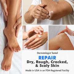 Dead skin removal with Ebanel Urea Cream on rough feet.