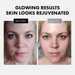 Eclat Skincare Hyaluronic acid serum bottle delivers deep moisture for a plumper look.