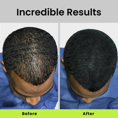 Eclipse Hair Fibers Dark Blonde color match blends with roots.