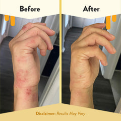 ECZEMA HONEY Antioxidant Body Oil close-up texture with silky finish.