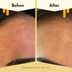 Creamy texture close up suitable for delicate facial skin during flare ups