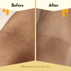 ECZEMA HONEY colloidal-oatmeal image showcases gentle cleansing and skin barrier support