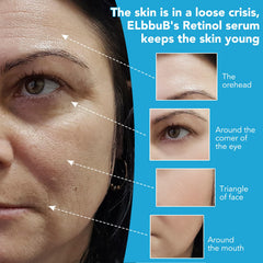 ELBBUB Hyaluronic Serum applied on skin demonstrates deep, lasting hydration.
