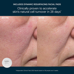 Elemis Dynamic Resurfacing Facial Wash bottle, cleanses while refining texture for smoother skin.