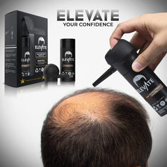 Elevate Hair Perfecting 2-in-1 Kit hairline coverage close-up showing seamless blend.
