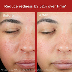 Green tint swatch on skin demonstrates color correction with EltaMD.
