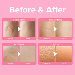 Application on leg using Enaskin Naturals Booty Cream for smoother texture.