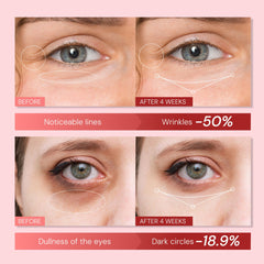 Enaskin Naturals eye cream applicator tip close-up for precise under-eye application