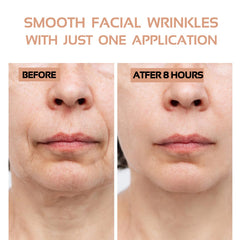 ENROSLU clear overnight patches on skin for discreet wear.