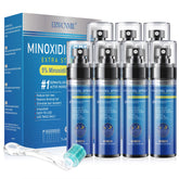 ERWCNMIE 5% Minoxidil spray bottle shown for scalp hair growth support.