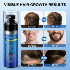 ERWCNMIE beard growth application targets thinning beard areas.