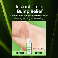 ESTETIST Razor Bump Roll-On texture shows smooth, fast-absorbing formula