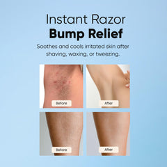 ESTETIST Razor Bump Roll-On being applied to leg for irritation relief.