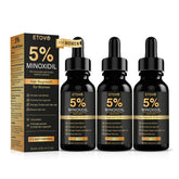 ETOVO 5% Minoxidil bottle ready for daily scalp treatment to support hair growth.