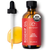 Eve Hansen Rosehip Oil bottle with dropper for deep hydration and radiant skin.