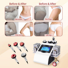 Expbom Body Machine cellulite massage heads target treated areas for home use.