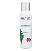 Exposed Skin Care Clearing Toner packaging closeup for revitalized skin prep
