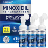 FIGTORUS 5% Minoxidil Foam bottle shown, designed for fuller-looking hair and easy daily use.