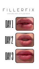 FillerFix cooling ceramic tip in use providing calm, soothing post-procedure relief.