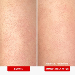First Aid Beauty KP Bump Eraser arm application demonstrates gentle exfoliation.