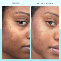 First Aid Beauty serum texture close-up showing a lightweight, soothing feel.
