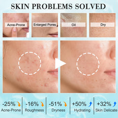 FITOEG Serum brightens the face and helps control shine for a balanced glow.