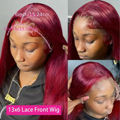 Fiumer HD lace front blends with skin for an invisible hairline.