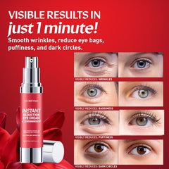 Floretsio under-eye bags before-after highlights potential reduction in puffiness