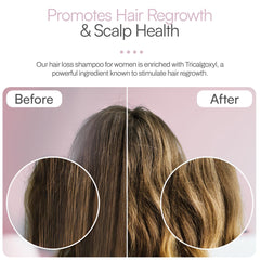 Foltene Strengthening Shampoo for Women scalp close-up suggests balanced scalp support