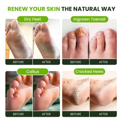 FOOT CURE spa scene showing a calming foot soak setup.
