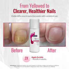 Footlogix Nail Tincture Spray label close-up shows ingredients and purpose.