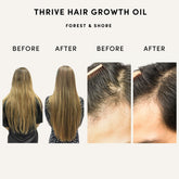 Forest & Shore hair growth oil dropper ready for precise scalp application and enhanced absorption.