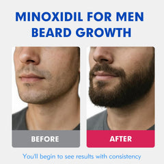 Fyntikal minoxidil dropper application for precise scalp targeting