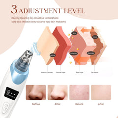 Gackoko 5 suction probes ready for customized skincare