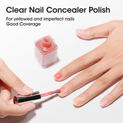 GELLEN ridge-filler action creates a smooth nail surface.