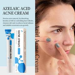 Texture swirl of Generic Azelaic Acid Cream indicating light absorption
