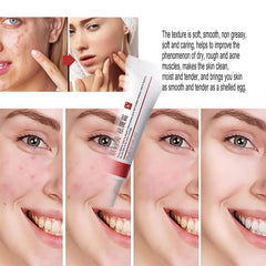 Generic Dark Spot Cream Face jar shows compact 20g container