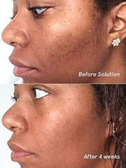 Glossier Solution texture close-up, showing liquid exfoliant for gentle skin renewal.