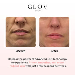 Glov Beauty LED mask remote control for easy session timing.