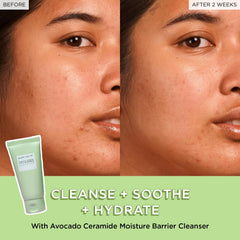 Glow Recipe Avocado Ceramide Cleanser ingredient visuals signaling ceramides and colloidal oatmeal benefits.