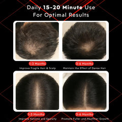 GlowFars 4-wavelength red light cap highlights full-spectrum care for thinning hair