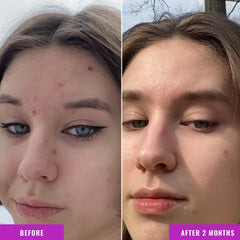 Good Molecules Niacinamide Serum in hand for quick application
