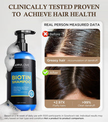 GOWILOVE Biotin Shampoo scalp-closeup features rosemary and menthol soothing scalp