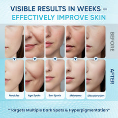 Greoay dark-spot serum dispense cap enables mess-free application.