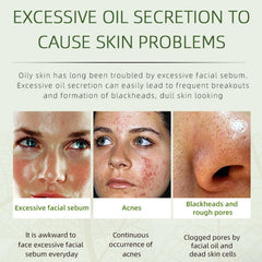 Grospe Herbal Acne Removing Cream jar shows rich texture for targeted spot care